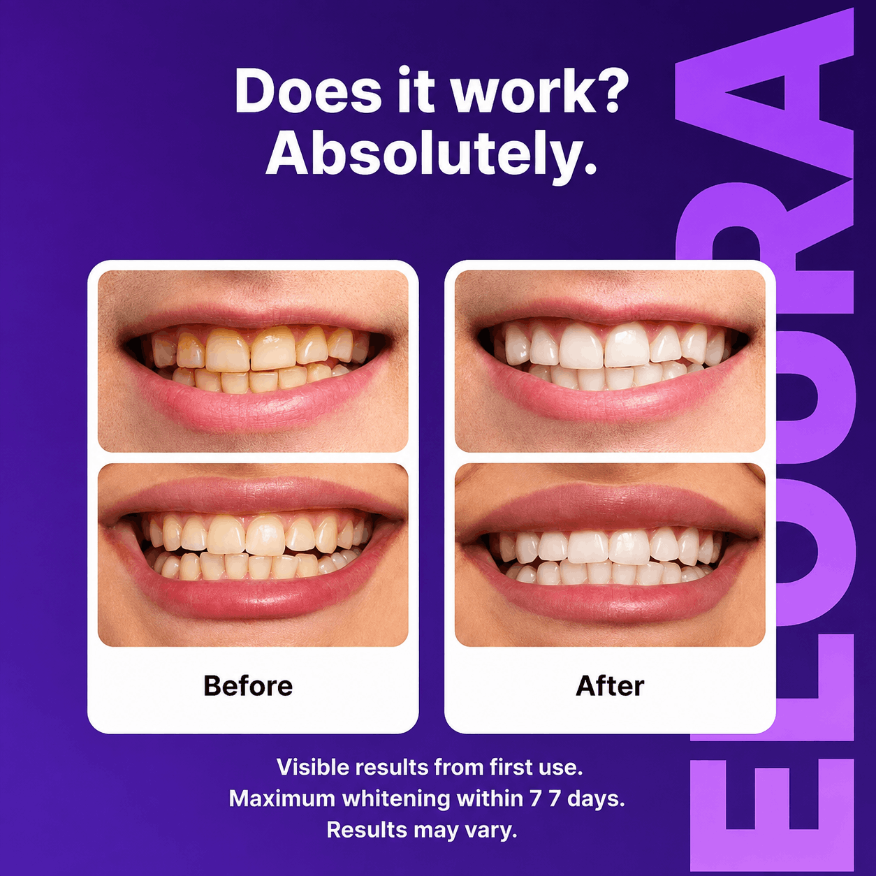 Before and after comparison of teeth whitening results, showing a smiling person's mouth with yellowed teeth labeled 'Before' and whiter teeth labeled 'After' on a purple background with the brand name ELOORAUAE.
