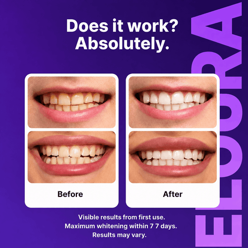 Before and after comparison of teeth whitening results, showing a smiling person's mouth with yellowed teeth labeled 'Before' and whiter teeth labeled 'After' on a purple background with the brand name ELOORAUAE.