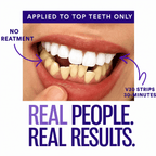 Promotional graphic for a teeth-whitening product showing a close-up of an open mouth with yellowed teeth and a strip applied to the upper teeth. Text reads 'APPLIED TO TOP TEETH ONLY,' 'NO TREATMENT,' 'V30 STRIPS 30-MINUTES,' and 'REAL PEOPLE.