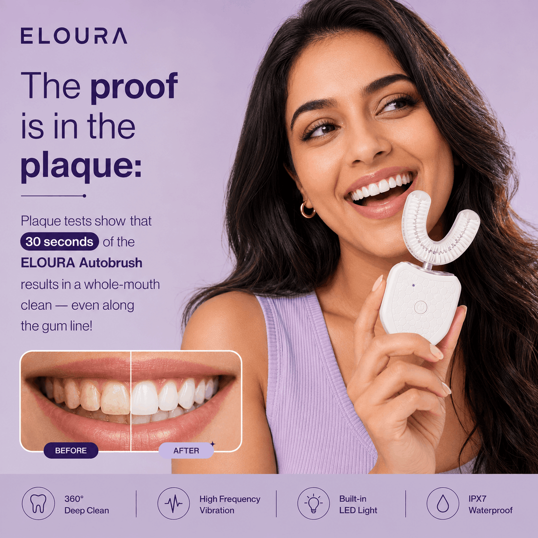 ELOURA Smile360 Pro™